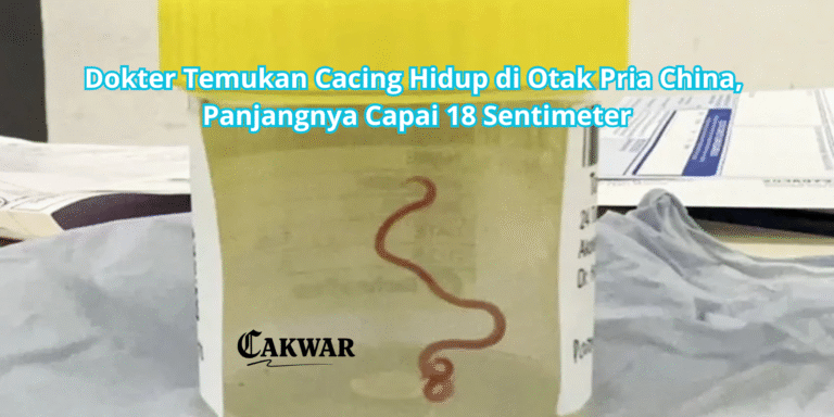 Dokter Temukan Cacing Hidup di Otak Pria China, Panjangnya Capai 18 Sentimeter