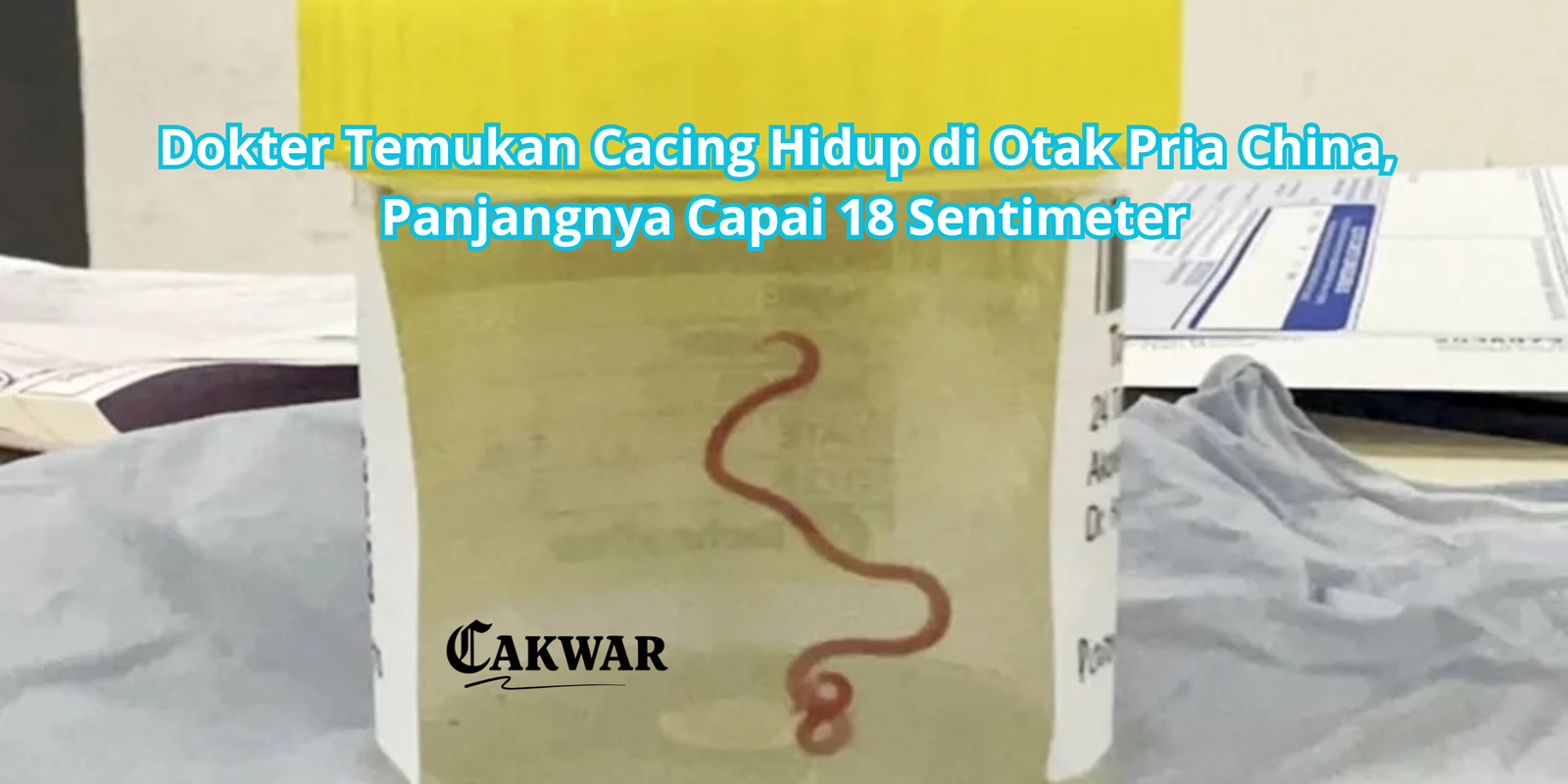 Dokter Temukan Cacing Hidup di Otak Pria China, Panjangnya Capai 18 Sentimeter